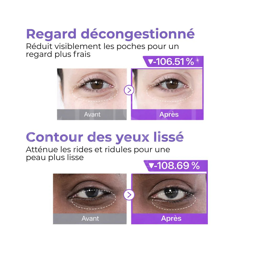 NUMBUZIN - No.9 NAD+ Collagen Under Eye Patches (5 paires)